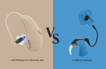 Hearing Aids vs. Cochlear Implants: Key Differences and Who They Help