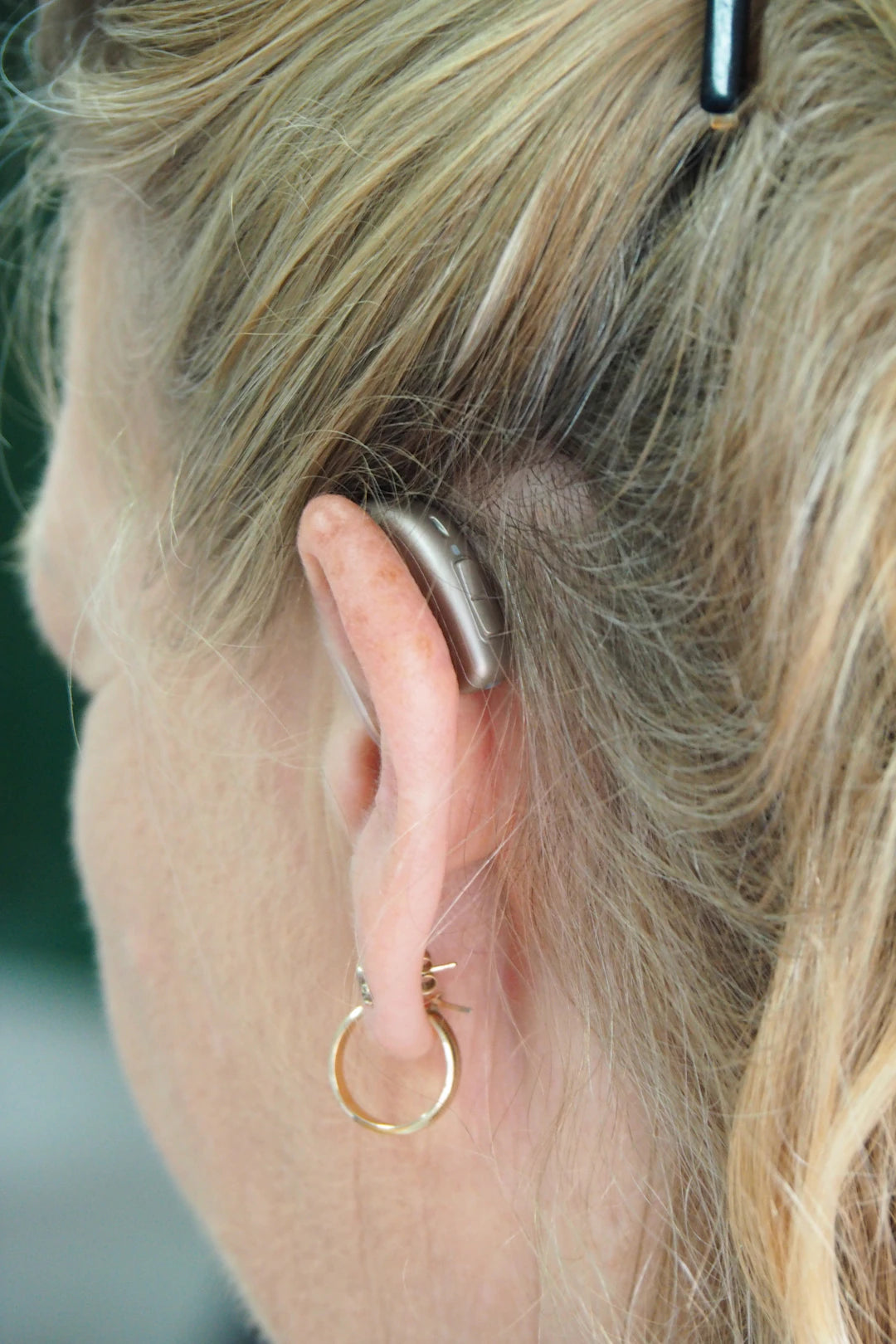 Unlocking Crystal Clear Sound: How to Improve Your Hearing Aid Experience